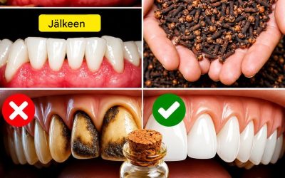 9 luonnollista tapaa poistaa plakkia ja hammaskiveä Lisätietoja ensimmäisessä kommentissa…