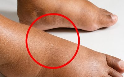 Tässä ovat seuraukset nukkumisesta… Näytä lisää
