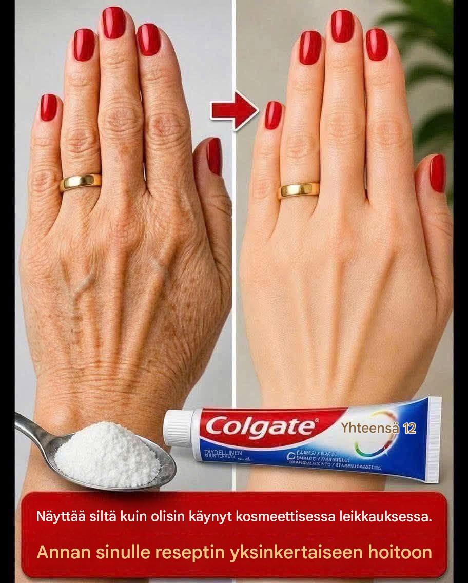 Katso tätä… nämä kädet näyttivät ikääntyneiltä, ​​täynnä näppyjä… lue lisää ensimmäisessä kommentissa 👇