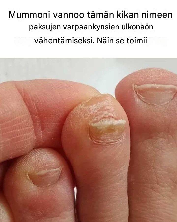 Niin hyvää! Kiitos nana!  Lue ensimmäinen kommentti