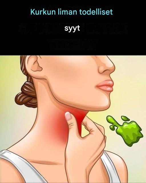 Jatkuvan liman ja liman kurkussa todelliset syyt ja miten niistä pääsee eroon Koko resepti 👇👇