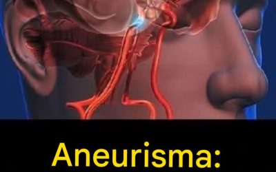 Aneurysma: merkkejä, joita ei pidä jättää huomiotta…