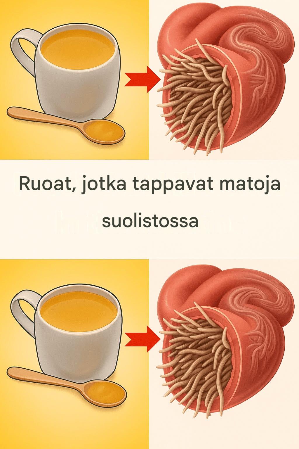 7 ruokaa, jotka tappavat matoja suolistossa